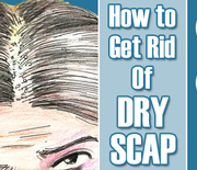 Thumb_get-rid-of-dry-scalp