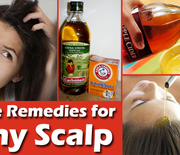 Thumb_remedies-for-itchy-scalp